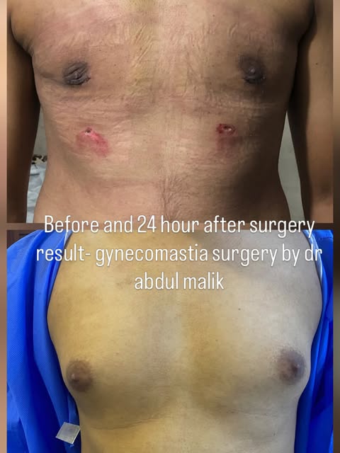 R&H Aesthetics by Dr. Abdul Malik
Plastic & Cosmetic Surgeon( Assistant Professor of Plastic Surgery