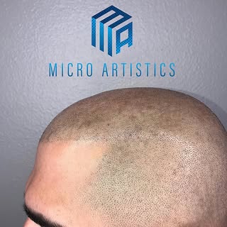All Natural Results 
SCALP MICRO PIGMENTATION 
Work done by @cutz310 
NO more hats 🧢 
NO more fiber