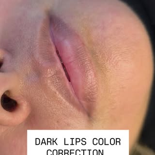 Dark Lip Neutralization is a journey, and this is why I love it so much ✨🤎

Look at the difference 