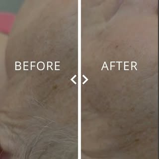 ✨ GLOW STARTS WITH SMOOTH SKIN ✨

Meet Dermaplaning — the perfect treatment for instantly smoother, 