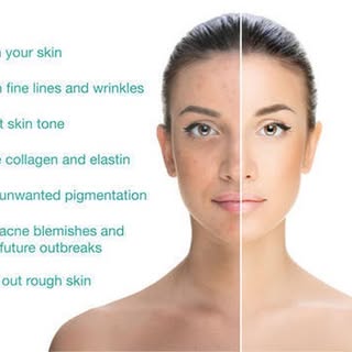 Ready to try something new and medical grade? 😘Our Retinol peels reduces wrinkles and blemishes, fi