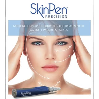 What does skin pen do to your skin?⠀⠀⠀⠀⠀⠀⠀⠀⠀
⠀⠀⠀⠀⠀⠀⠀⠀⠀
SkinPen is a micro-needling tool that uses sh