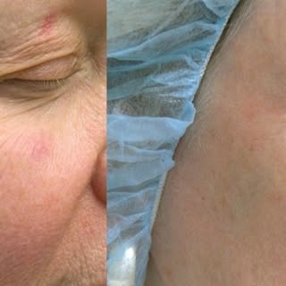 Fun Facts by Dr. Alison Abiri "The building blocks of smooth, youthful skin are elastin and collagen