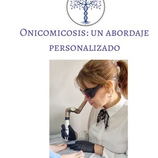 🦶✨ ¿Cómo ayuda el láser en el tratamiento de los hongos en las uñas?

La onicomicosis es una infecc