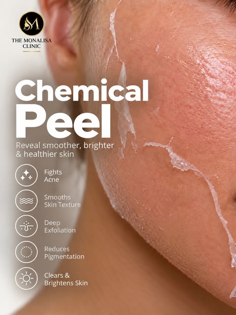 ✨ Dull skin? Uneven tone? Acne marks? Your skin may need a reset.

A Chemical Peel gently exfoliates