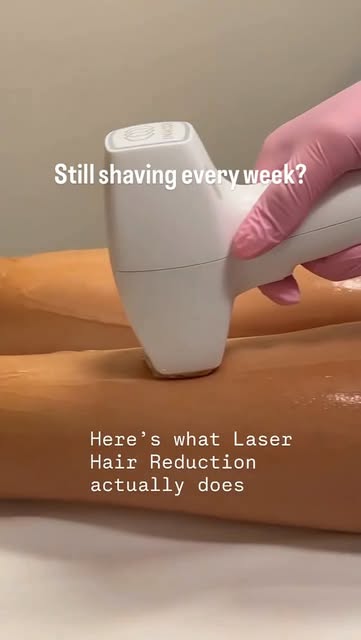 Thinking about Laser Hair Reduction? Here are 5 things nobody should skip before starting 👀

Laser 