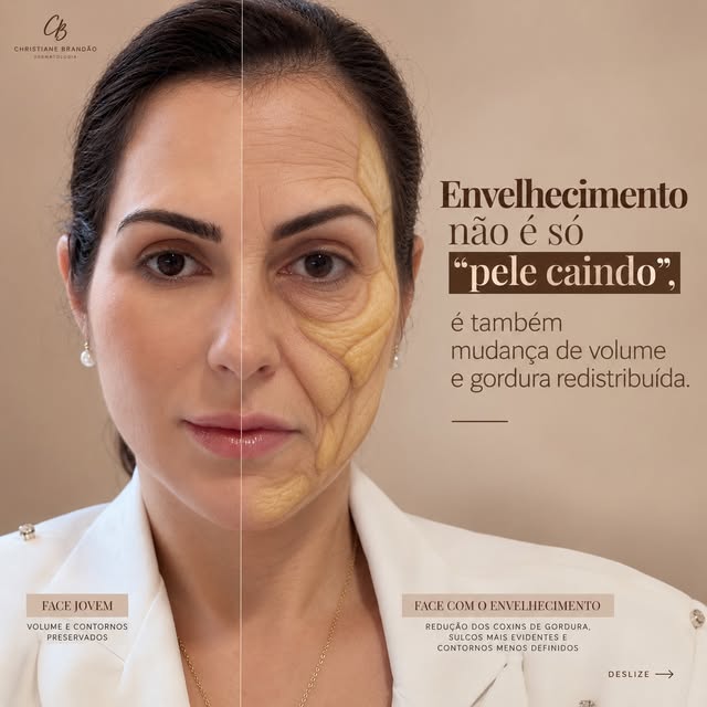 Você já reparou que, com o passar dos anos, o rosto não ganha apenas rugas… ele também muda de forma