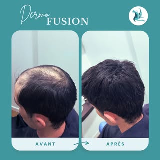 Chez Mes Nouveaux Cheveux, découvrez aujourd’hui une nouvelle transformation incroyable grâce à notr