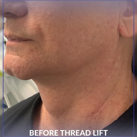 One of the biggest trends we'll see more of this year is the increase in Combination Procedures.

Co