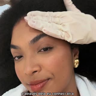 O fio de cabelo é estrutura, proteína, lipídio, água e memória química.

Quando o fio é tratado com 