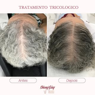 Quando o tratamento vai além da queda…

O objetivo era tratar queda, alopecia e alterações do couro 