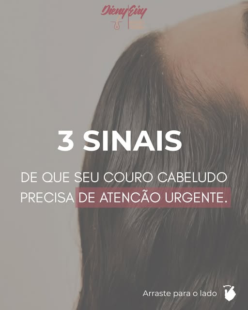Seu couro cabeludo está dando sinais. Você está percebendo?

Coceira, descamação, sensibilidade e af
