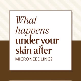 It’s not magic, it’s science — see what microneedling does!
.
#Microneedling | #SkinRejuvenation | #