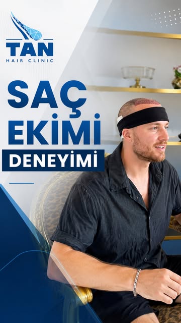 Saç ekimi sürecinde yalnızca sonuç değil, o sonuca giden deneyim de önemlidir.

Hastamız; transfer s