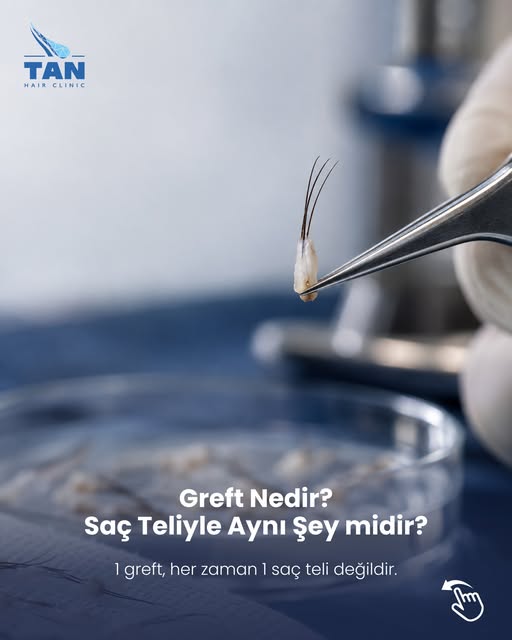 Saç ekiminde “kaç greft?” sorusu sık sorulur; ancak greft sayısı ile saç teli sayısı aynı şeyi ifade