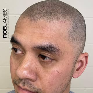 Naturally scruffy, asymmetrical hairline and increased density throughout all seamlessly blended int