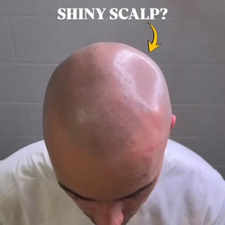 Shiny scalp reflects light.

That’s why SMP can sometimes look less natural under lighting or photos