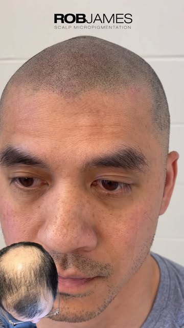 Imperfections are our perfection.

A perfectly straight, perfectly symmetrical hairline can look lik
