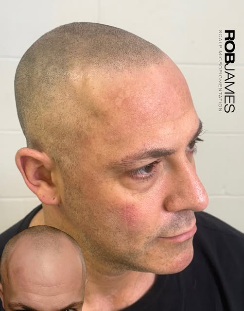 Natural SMP. Done Right.

When a client’s comes back their touch ups, I love hearing “No one has sai