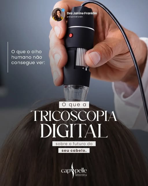 A olho nu, dois couros cabeludos com queixa de rarefação podem parecer idênticos. Mas sob as lentes 