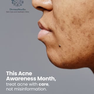June is Acne Awareness Month ✨

A reminder that every skin journey is different, and every step towa