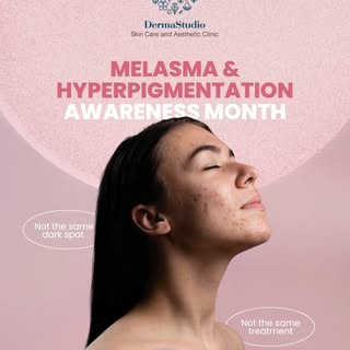 Hyperpigmentation and melasma are common skin concerns, but understanding what causes them is the fi