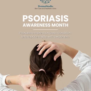 Psoriasis is more than what appears on the skin. It is a chronic autoimmune condition that can affec