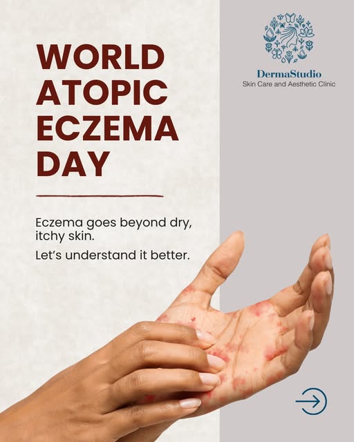 Living with atopic eczema can affect more than the skin. Recurring flare ups, discomfort, and sensit