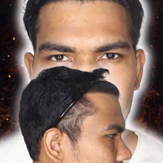 💻 Visit us: www.besthairhelp.com
📞 Call/WhatsApp: +91 8273645677
#HairTransplantResults #HairTrans