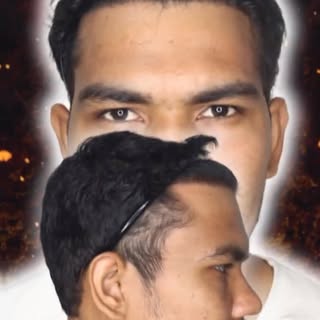 My Hair Transplant Result Of 6 Months Using Derma Technique 2025.
Visit www.besthairhelp.com for cli