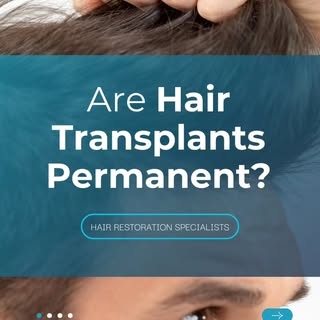 Are hair transplants permanent? Swipe to find out! 

Don't forget we offer free in office & virtual 