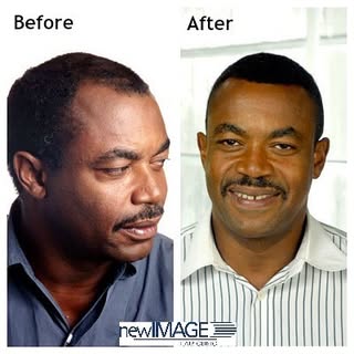 Give yourself the gift of hair this holiday season by calling New Image Hair Clinic! 1-888-615-0243 