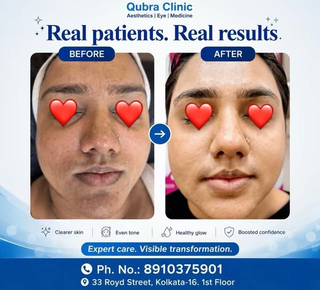 Real patients. Real results. ✨ See the difference expert aesthetic care can make—from uneven skin to
