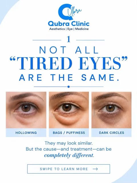 Not all under-eye concerns are the same 👀

Hollows, bags and dark circles can look similar, but the