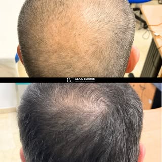 📸 Un resultado que no necesita presentación.

Detrás de cada imagen hay un proceso cuidado, persona