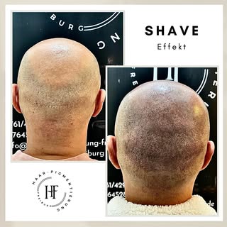 ⚜️ Haarpigmentierung-Freiburg ⚜️

Wenn Sie unter Haarausfall, Geheimratsecken, undichten Haaren, Nar