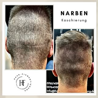 ⚜️ Haarpigmentierung-Freiburg ⚜️

Wenn Sie unter Haarausfall, Geheimratsecken, undichten Haaren, Nar