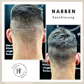 ⚜️ Haarpigmentierung-Freiburg ⚜️

Wenn Sie unter Haarausfall, Geheimratsecken, undichten Haaren, Nar