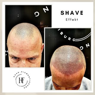 ⚜️ Haarpigmentierung-Freiburg ⚜️

Wenn Sie unter Haarausfall, Geheimratsecken, undichten Haaren, Nar