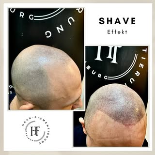 ⚜️ Haarpigmentierung-Freiburg ⚜️

Wenn Sie unter Haarausfall, Geheimratsecken, undichten Haaren, Nar