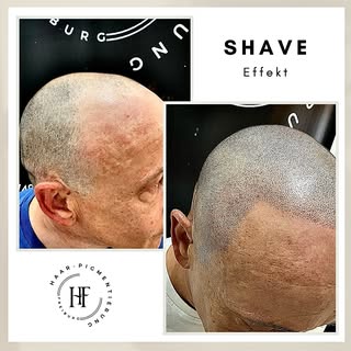 ⚜️ Haarpigmentierung-Freiburg ⚜️

Wenn Sie unter Haarausfall, Geheimratsecken, undichten Haaren, Nar
