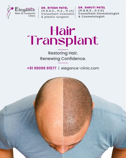 ✨ Restore your hair, revive your confidence! Experience advanced Hair Transplant solutions designed 