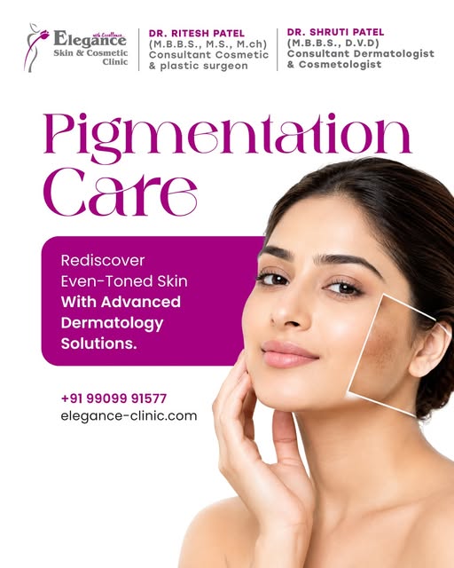 Pigmentation concerns deserve expert-led care, not guesswork. ✨ Rediscover a more even-looking skin 