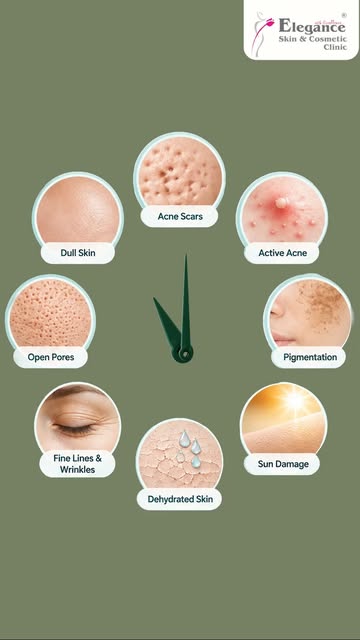It’s time for flawless skin! ⏰ Discover targeted treatments like lasers, microneedling, and Botox fo