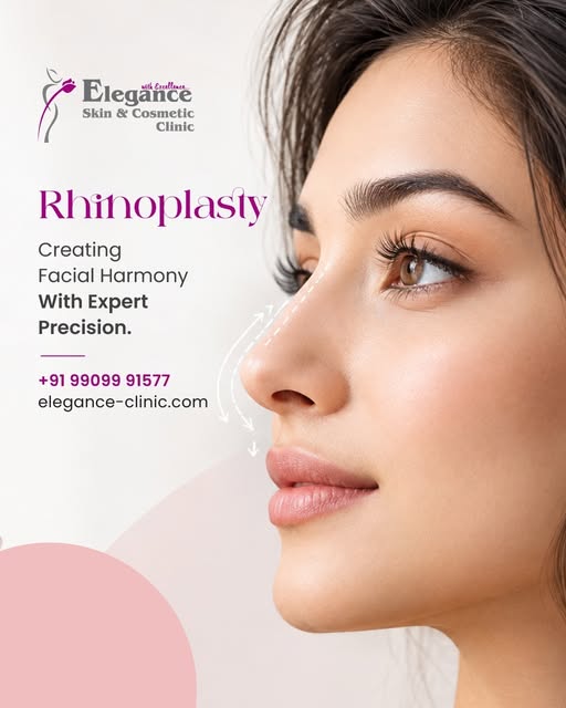 Rhinoplasty is about creating better facial harmony with a shape that complements your natural featu