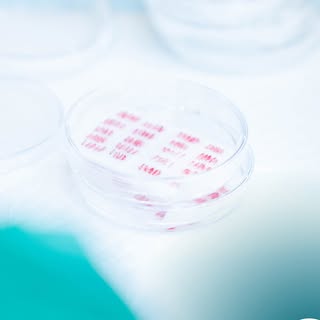 Een haartransplantatie is het verplaatsen van gezonde haarzakjes naar kale gebieden, die ontstaan zi