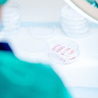 Het aantal grafts (groepjes haarzakjes) van een haartransplantatie behandeling hangt af van het te b