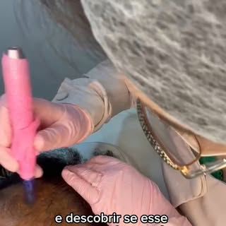 Cuidar dos cabelos também é sobre saúde!
Combinando alta frequência, vacuoterapia e laser vermelho +