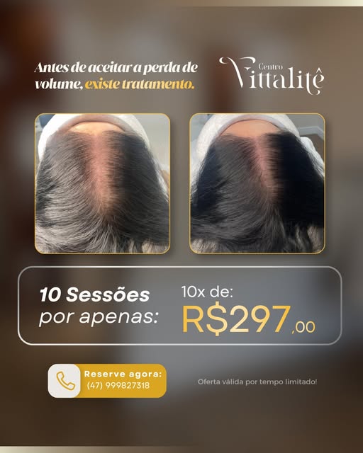 Antes de aceitar a perda de volume como algo definitivo, entenda que existem possibilidades de cuida