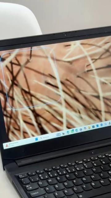 Sua queda de cabelo tem uma causa. E tratar só o sintoma não resolve. 🌱

No Protocolo Raiz Forte da